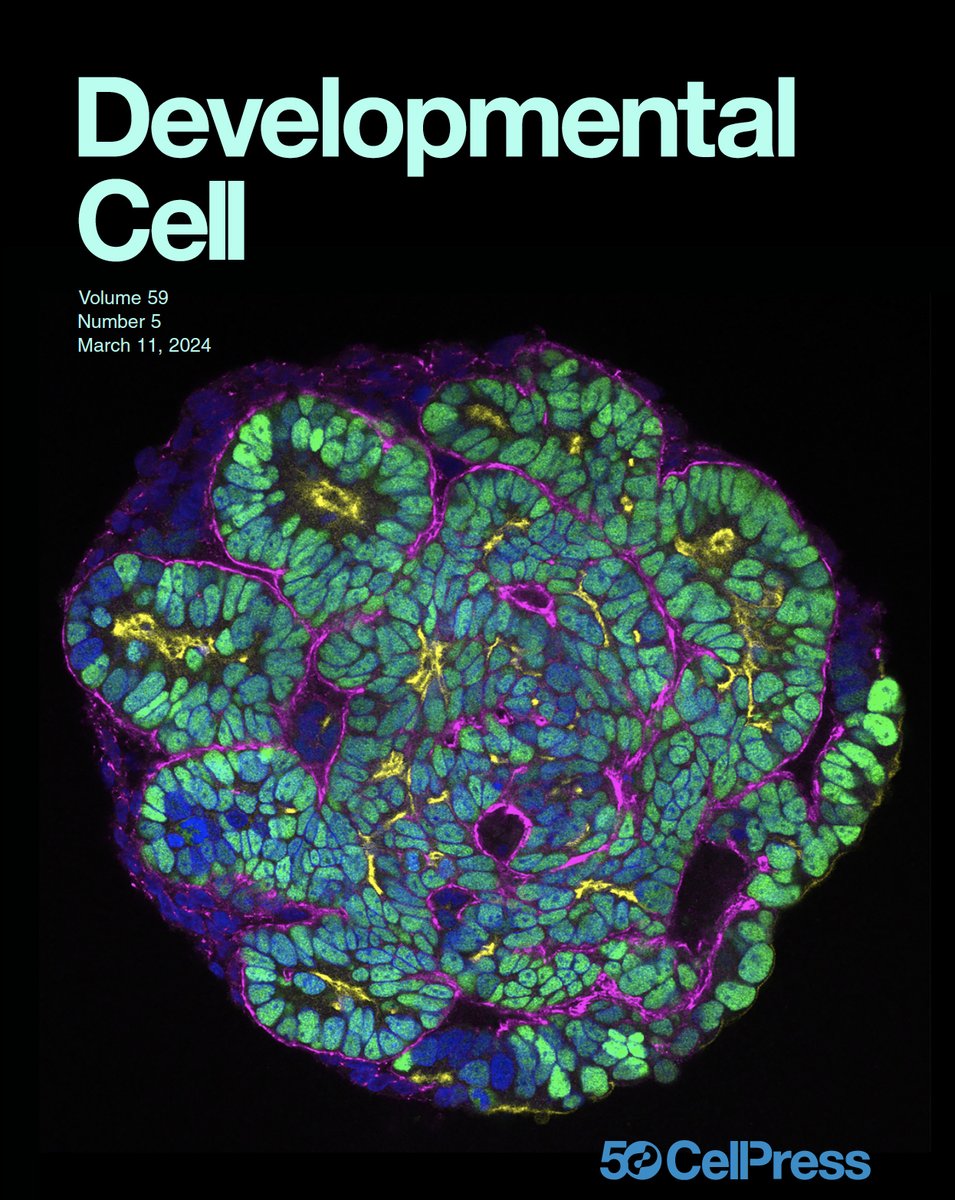 Very happy our kidney organoid paper on MET/epithelial polarisation in nephrogenesis is now out in print at @Dev_Cell, and we have the cover picture! Great work by @jpnigby, @ClatworthyLab, @drbstewart, @AstraZeneca, done @CellBiol_MRCLMB @MRC_LMB cell.com/developmental-…