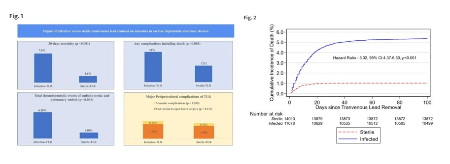 🚨New #FreeRead Article in @JICE_EP Impact of Infective vs Sterile Transvenous Lead Removal on 30-day Outcomes in CIEDs 📖🧐 rdcu.be/dAPWj by @fahimeh_talaei, Qi-Xuan Ang, @DrMCTan, Mustafa Hassan, Luis Scott, Yong-Mei Cha, @DrJustinZLee & @KTamirisaMD #EPeeps