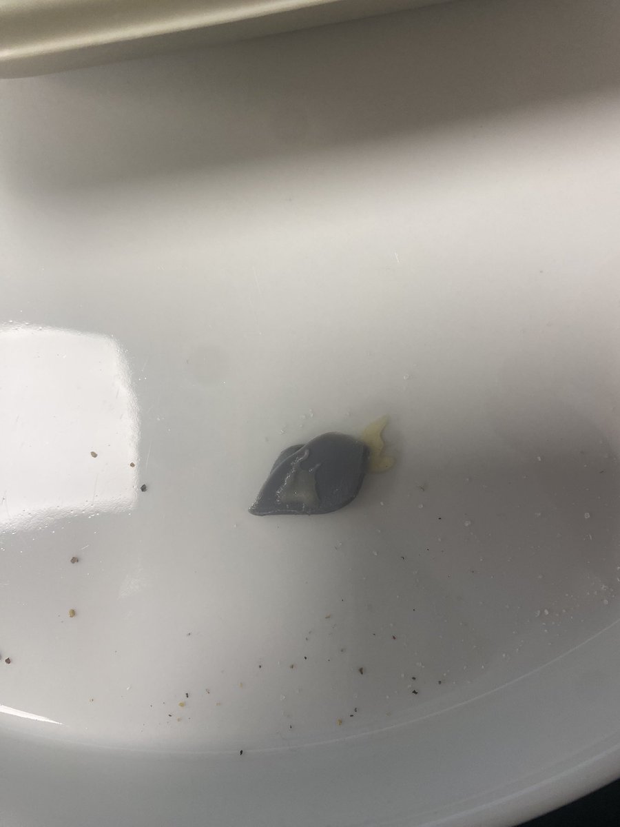 S__Rags's tweet photo. @asda purchased a mac n cheese from your Superstore in Chatham as a little treat after being so good with my food… what is this in my food please? #Asda https://t.co/VWKlmNuGAg