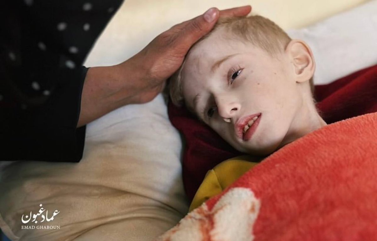 Timesofgaza's tweet photo. Don't Look Away: An update on 6 year-old Fadi Al-Zant's condition documents his critically deteriorating health condition caused by severe malnutrition and dehydration at Kamal Adwan Hospital in Northern Gaza https://t.co/XAI2js8L1n