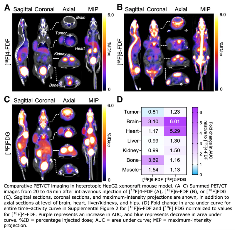 New PET Radiotracer Maps Fructose Metabolism to Detect Diseases

Read more ➡️ bit.ly/3IxTwnN
<a href="/JournalofNucMed/">JNM</a> <a href="/MolMedLabuO/">Molecular Medicine Lab</a>
#RadOnc #PET #RadOncNews #NuclearMedicine