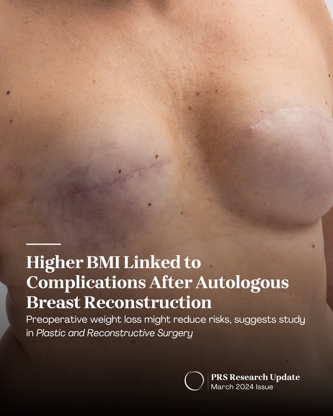 Breasts After Weight Loss 2024: Transformation Tips & Advice