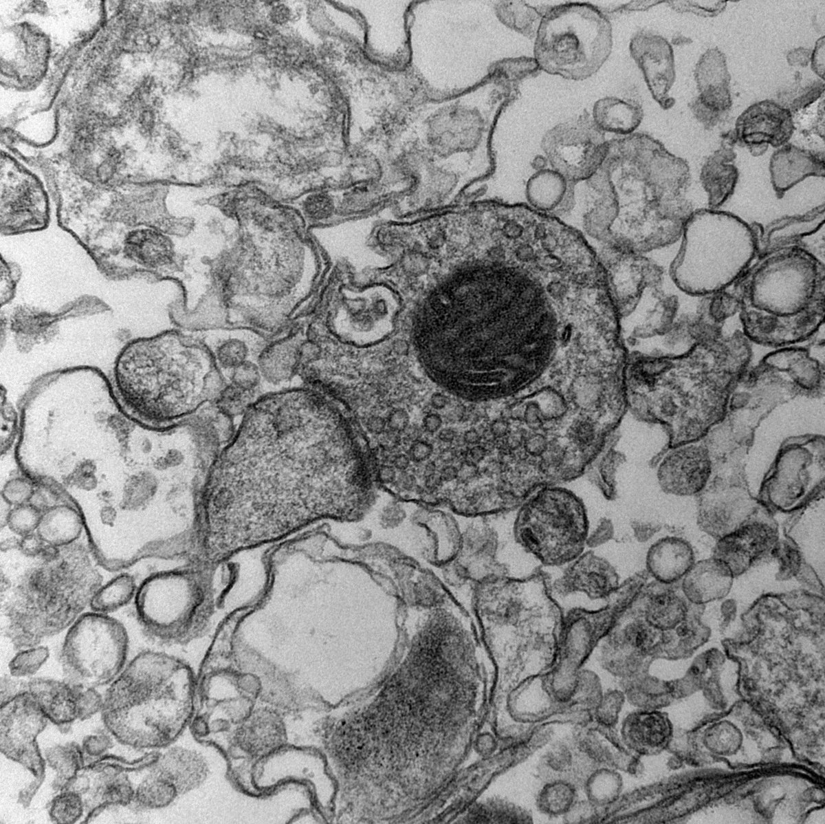 VeronicaGiust10's tweet image. Happy Brain Awareness Week🧠

#synapse  #synaptosome #BrainAwarenessWeek2024