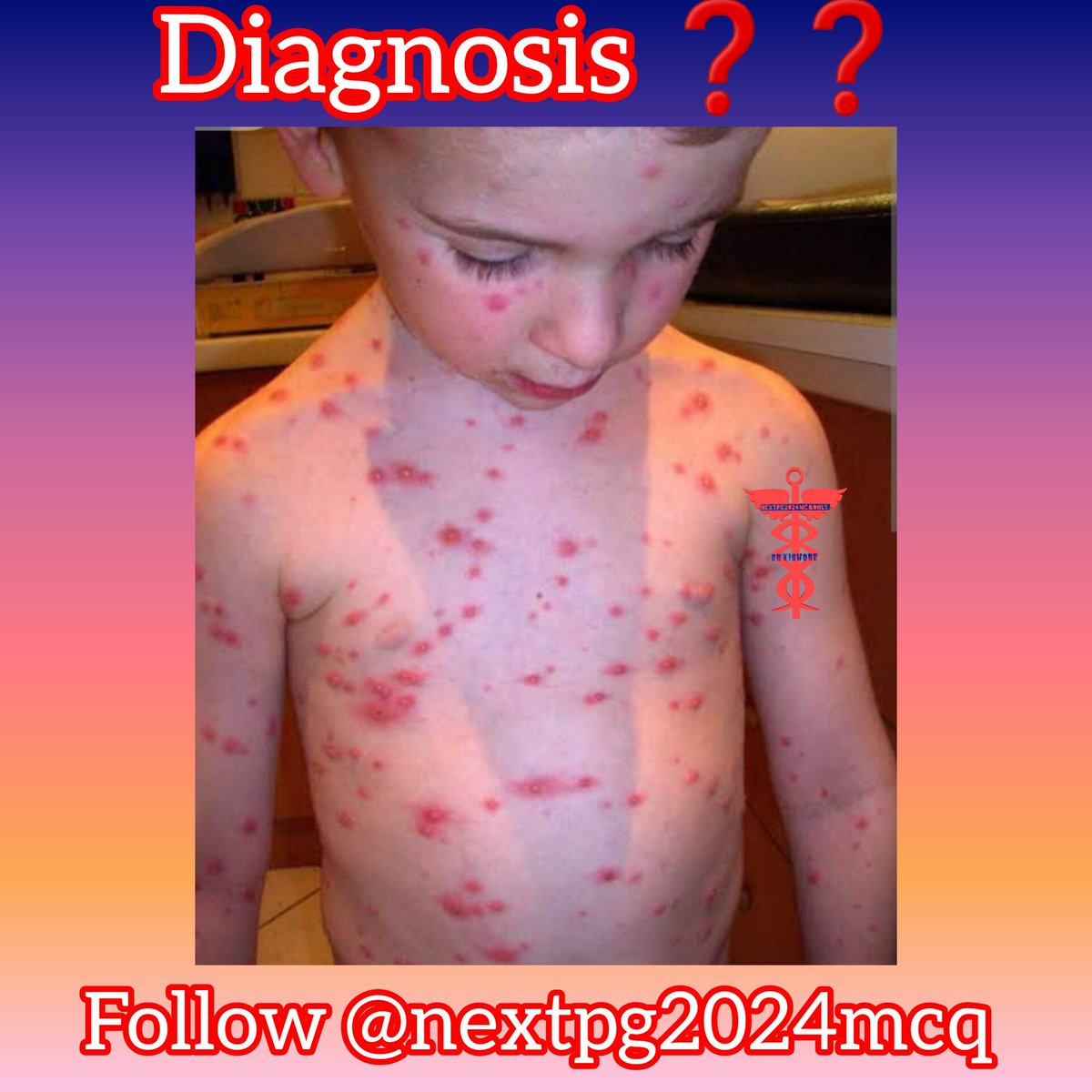 24ptka's tweet image. CLINICAL MCQ:
#NEETPG2024 
#fmge2024 
#nextpg 
#inicet2024 
#medico
#neetpg
#medicine