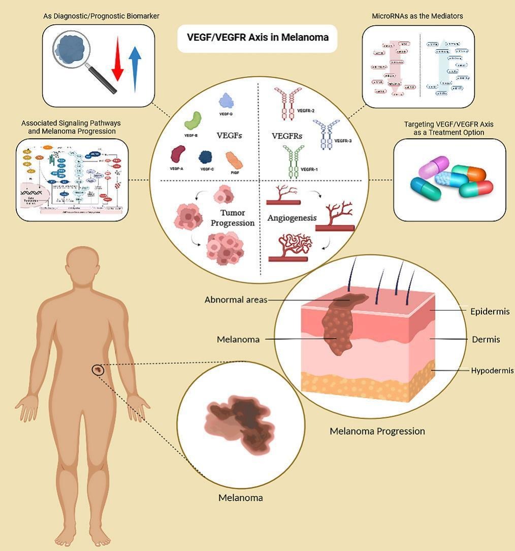 Hot off the press! Malekan M, Haass NK, Rokni GR, Gholizadeh N, Ebrahimzadeh MA, Kazeminejad A (2024) VEGF/VEGFR axis and its signaling in melanoma: Current knowledge toward therapeutic targeting agents and future perspectives. Life Sciences, doi.org/10.1016/j.lfs.…