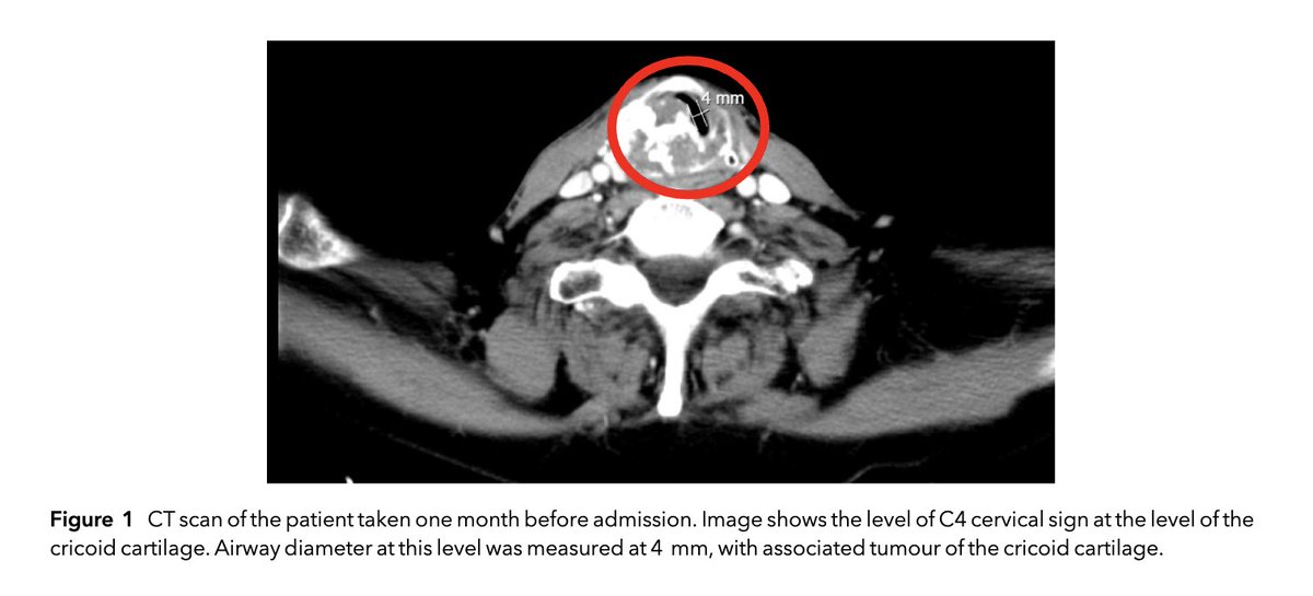 𝘈𝘯𝘢𝘦𝘴𝘵𝘩𝘦𝘴𝘪𝘢 𝘙𝘦𝘱𝘰𝘳𝘵𝘴 tweet media