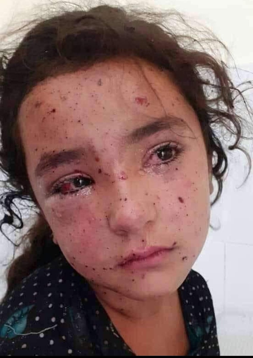 NekadarolduTR's tweet photo. KANAYAN YARAMIZ GAZZE...

Gazze'de yaşanan zulme sessiz kalmayın...

Bir zulmü engelleyemiyorsanız onu mutlaka DUYURUN PAYLAŞIN. https://t.co/C62MU3MqQf