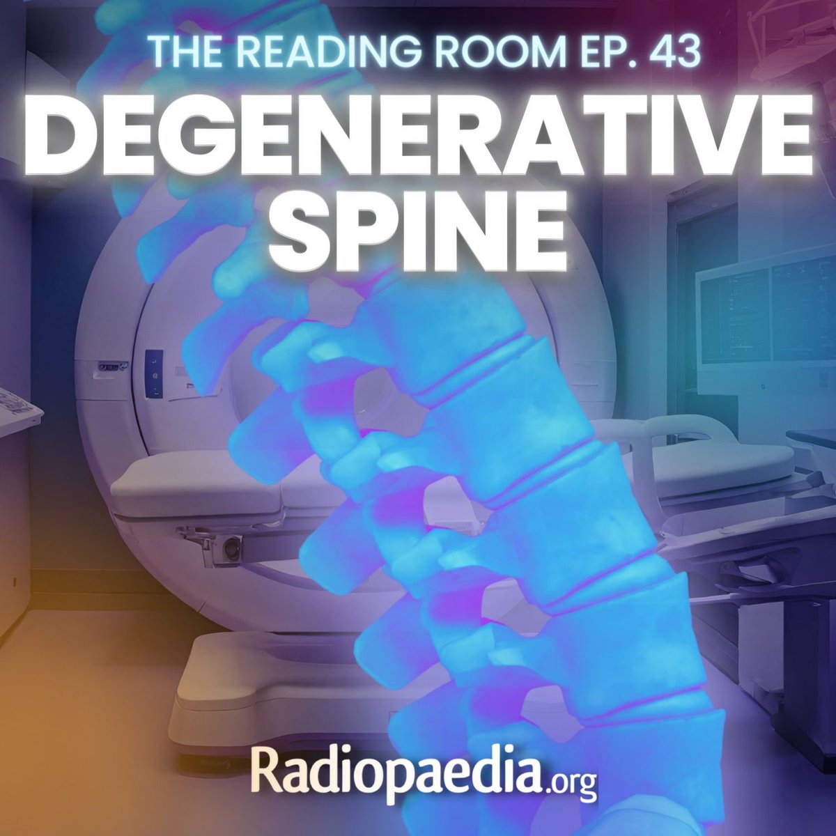 DrAndrewDixon's tweet image. A new Radiopaedia Reading Room podcast ep has arrived! 

I’m joined by the wonderful @WendeNGibbs and @docskalski for a chat about degenerative and post-operative spine imaging. 

🎧 radiopaedia.org/podcast 

#spinerad #neurorad #mskrad