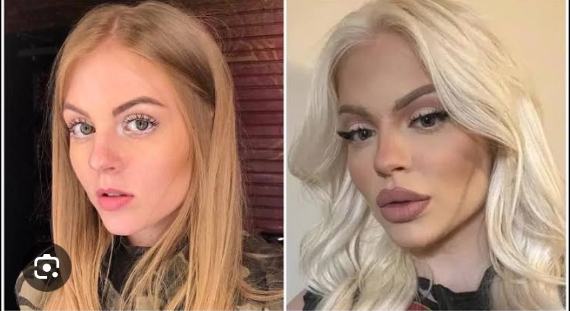 luisapontes's tweet image. Inacreditável a normalização disso daqui, precisamos com urgência voltar no jogo da vida e rever os nossos padrões, conceitos e modelos sociais! #helpusgod 🫠

Fonte das imagens: mixme.com.br/fatos-curiosos…