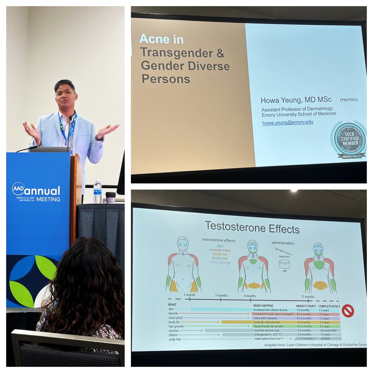 Healio Dermatology (@healioderm) on Twitter photo ๐Acne can be severe in transgender persons, <a href="/DrHowaYeung/">Howa Yeung, MD MSc (he/him)</a> said at #AAD2024:
๐ T therapy can induce persistent acne
๐ Chest binders can trigger acne early
๐ Acne impacts on patients are under appreciated
โThis is not a transient rite of passage.โ
<a href="/AADmember/">AADmember</a> <a href="/GoHealio/">Healio</a> ๐Acne can be severe in transgender persons, <a href="/DrHowaYeung/">Howa Yeung, MD MSc (he/him)</a> said at #AAD2024:
๐ T therapy can induce persistent acne
๐ Chest binders can trigger acne early
๐ Acne impacts on patients are under appreciated
โThis is not a transient rite of passage.โ
<a href="/AADmember/">AADmember</a> <a href="/GoHealio/">Healio</a>