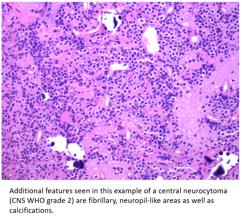 neuropathology tweet picture