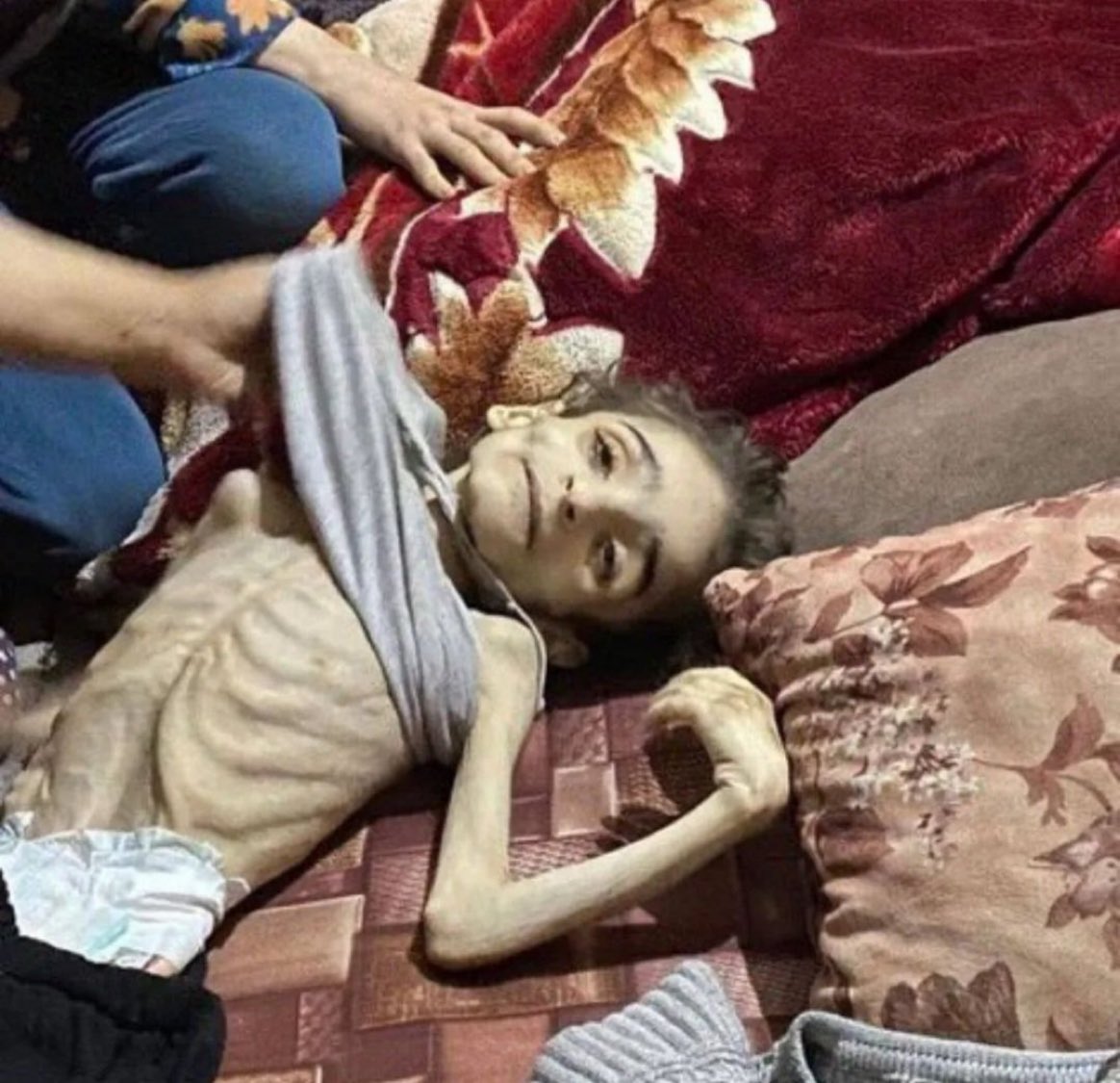 drhossamsamy65's tweet photo. ذنب اطفال غزة في رقبتكم يا مسلمين…

صورة تختصر المجاعة في شمال غزة
#GazaStarving https://t.co/VlYp3bW5Zk