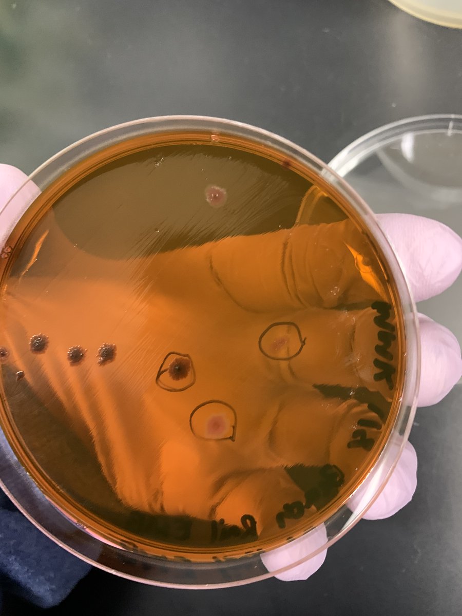 Germ of an Idea 🦠 Ohio Wesleyan Student Mindi Klaus '25 Explores Antibiotic Resistance at Playgrounds in Arizona, Ohio ➡️bit.ly/OWUGermofanIdea