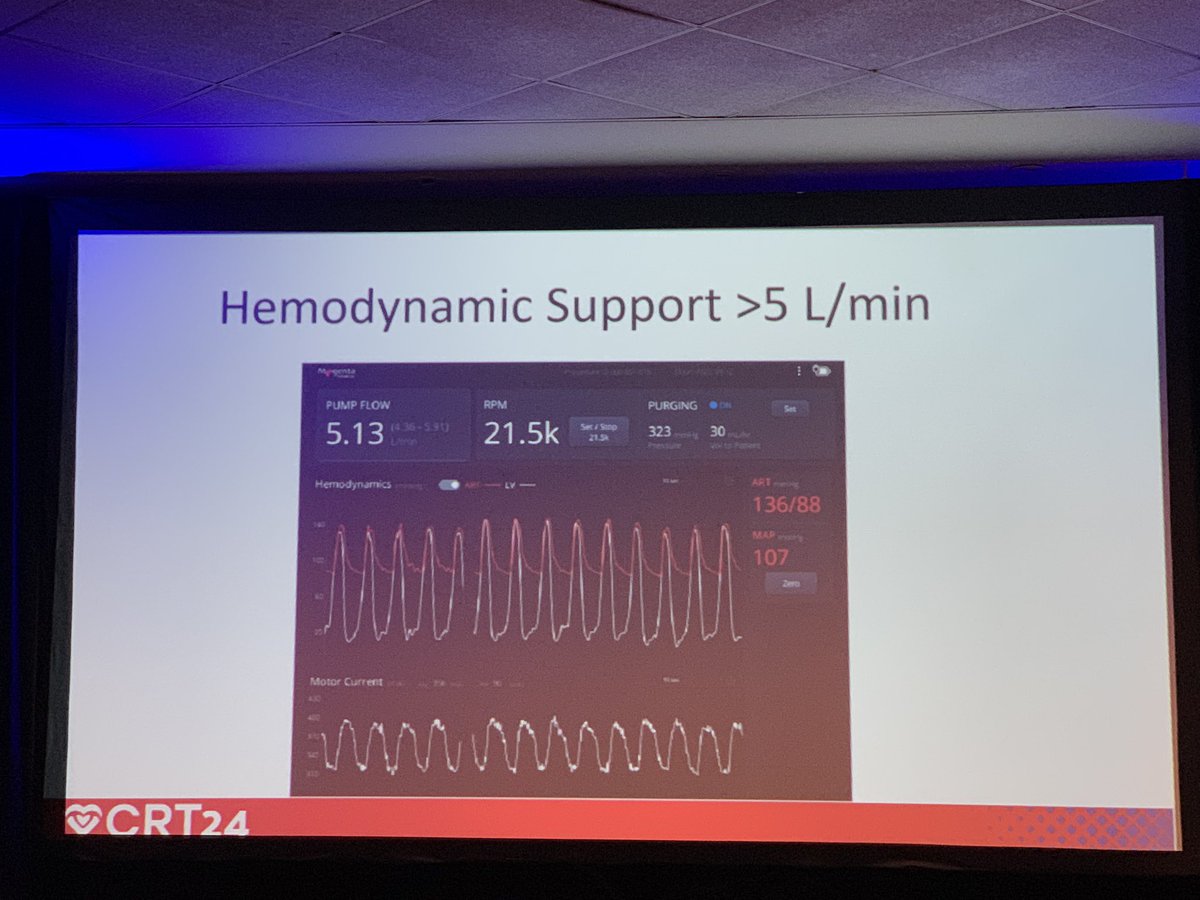 Chad Morreale, DO (@cvomed) on Twitter photo Exciting progress in pVAD field! <a href="/MagentaMed/">Magenta Medical Ltd.</a> developing 30F pump placed thru 10F sheath. Providing >5 L/min. Investigating high risk PCI and cardiogenic shock <a href="/CRT_meeting/">CRT Meeting</a> #CRT2024 #CardioTwitter #ACCFIT Exciting progress in pVAD field! <a href="/MagentaMed/">Magenta Medical Ltd.</a> developing 30F pump placed thru 10F sheath. Providing >5 L/min. Investigating high risk PCI and cardiogenic shock <a href="/CRT_meeting/">CRT Meeting</a> #CRT2024 #CardioTwitter #ACCFIT