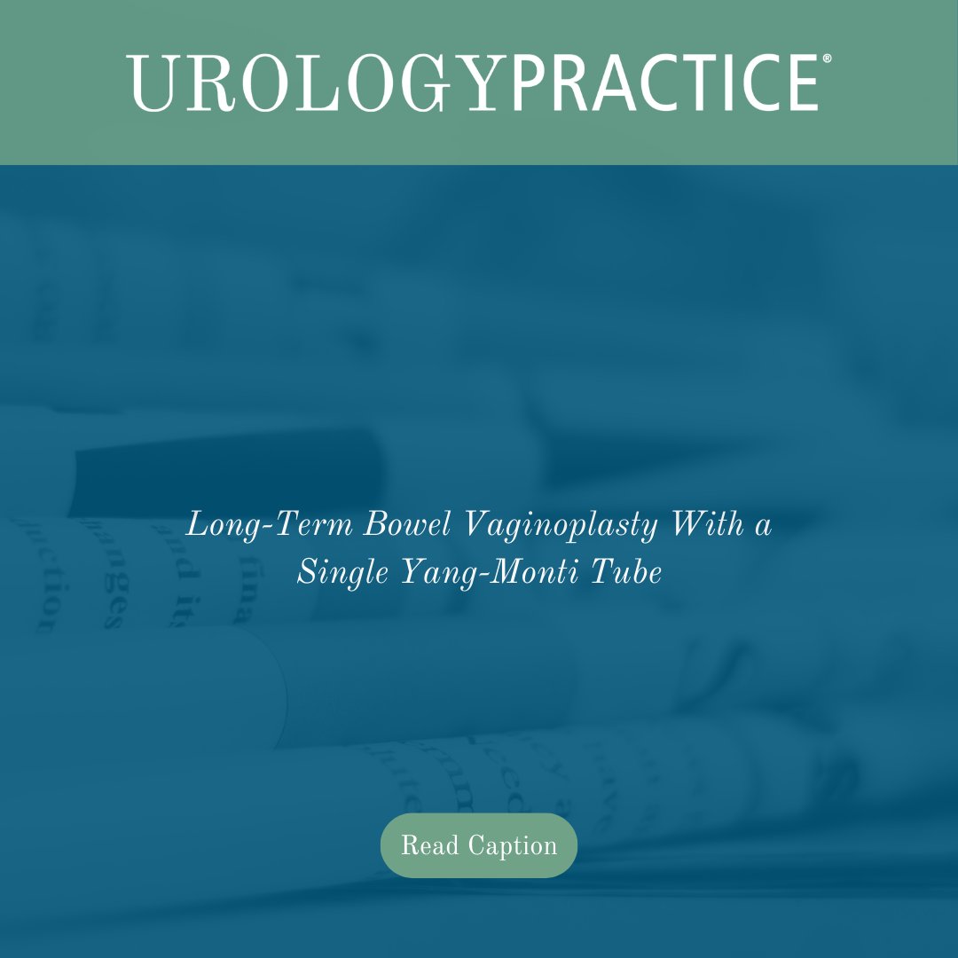 Long-Term Bowel Vaginoplasty With a Single Yang-Monti Tube 📰 Read the full article here ➡️ bit.ly/4arh75F #Urology #AUA