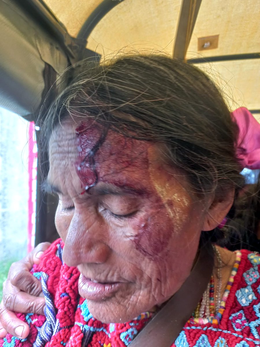 Sie7edeChiapas's tweet image. #Trifulca en plebiscito del #PartidoVerdeEcologista de México en Chenalhó, Chiapas

Terminó en una trifulca que dejó a una #mujer de la tercera edad #herida y varias #personas #golpeadas.