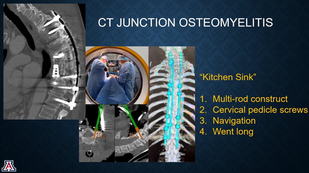 AliBaajMD's tweet photo. Thrilled to be giving a talk on cervical-thoracic jxn pathology & fixation techniques at #IMAST next month. Be sure to join us in beautiful #SanDiego for a terrific meeting on technology and innovations in spinal deformity surgery.
👉 https://t.co/T18Y3TTD8g for registration. https://t.co/ReM8ujBRZf