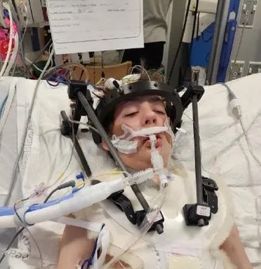 EndWokeness's tweet image. Another day, another border tragedy.  

Travis Wolfe was hit by a car on December 20 2023, a day before his 12th birthday.

The driver was an illegal from Venezuela who drove the wrong way at 70+ mph causing a head-on collision. Edina Bracho.

He passed away last week, on March…