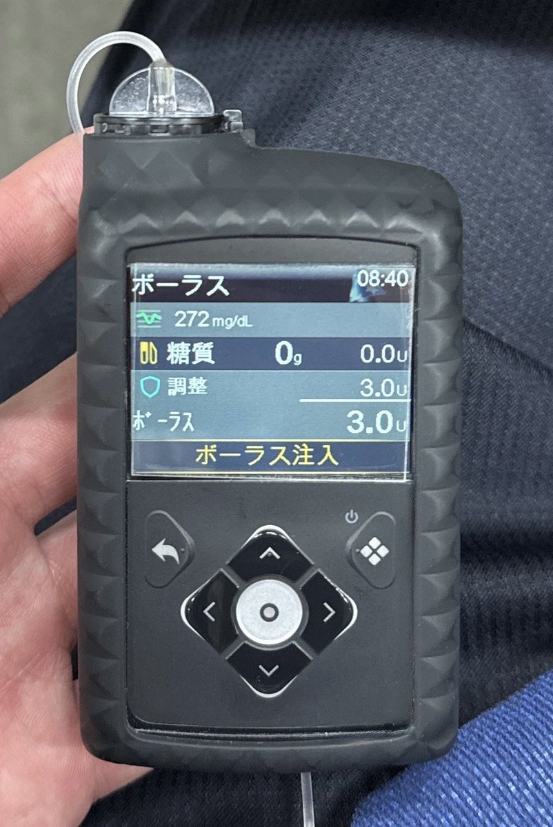 T1D_Takahiro's tweet image. スマートガードでも下がらないから、マニュアルで入れようとしたら、0gでも調整3.0Uも入る

自動補正ボーラスって思ってたより保守的なんだけど、これぐらいバンバン入れちゃってくれてもいいのよポンプさん！
#780G #780GMedtronic