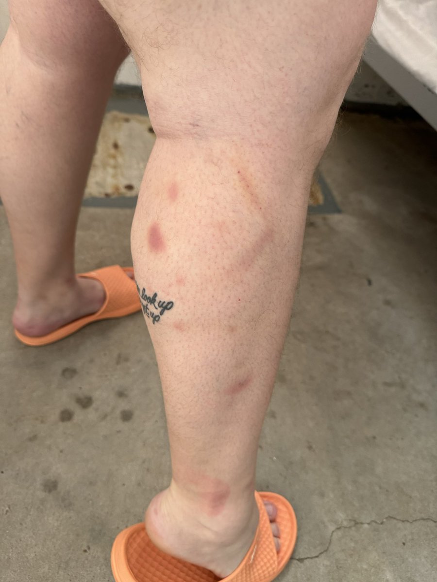 CagedBearDTX's tweet photo. Going to the Doctor tomorrow and trying to figure out how I can explain or hide the bruises from prison fights without them thinking I’m a victim of DV lol
#prisonfights #inmate #incarceration #bruises #convict #doctor https://t.co/irAocfIb86
