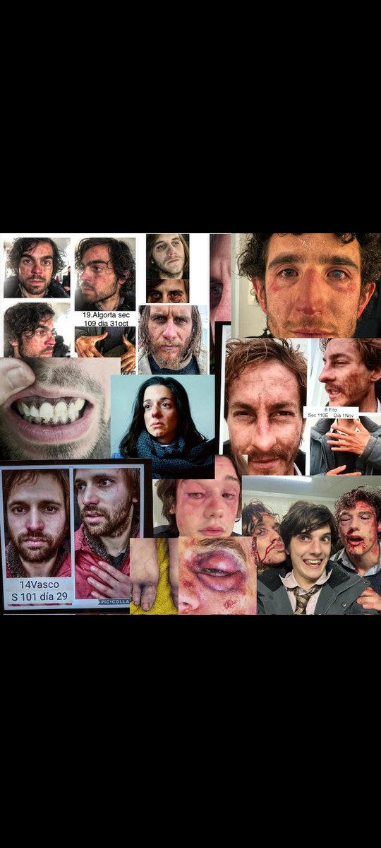 Juanicar_fan's tweet photo. Los de los Oscars tienen miopía y Astigmatismo o que?? Osea poor things no es nada a comparación es esto #queinjusto #Oscars #LaSociedadDeLaNieve https://t.co/bscT4atUce