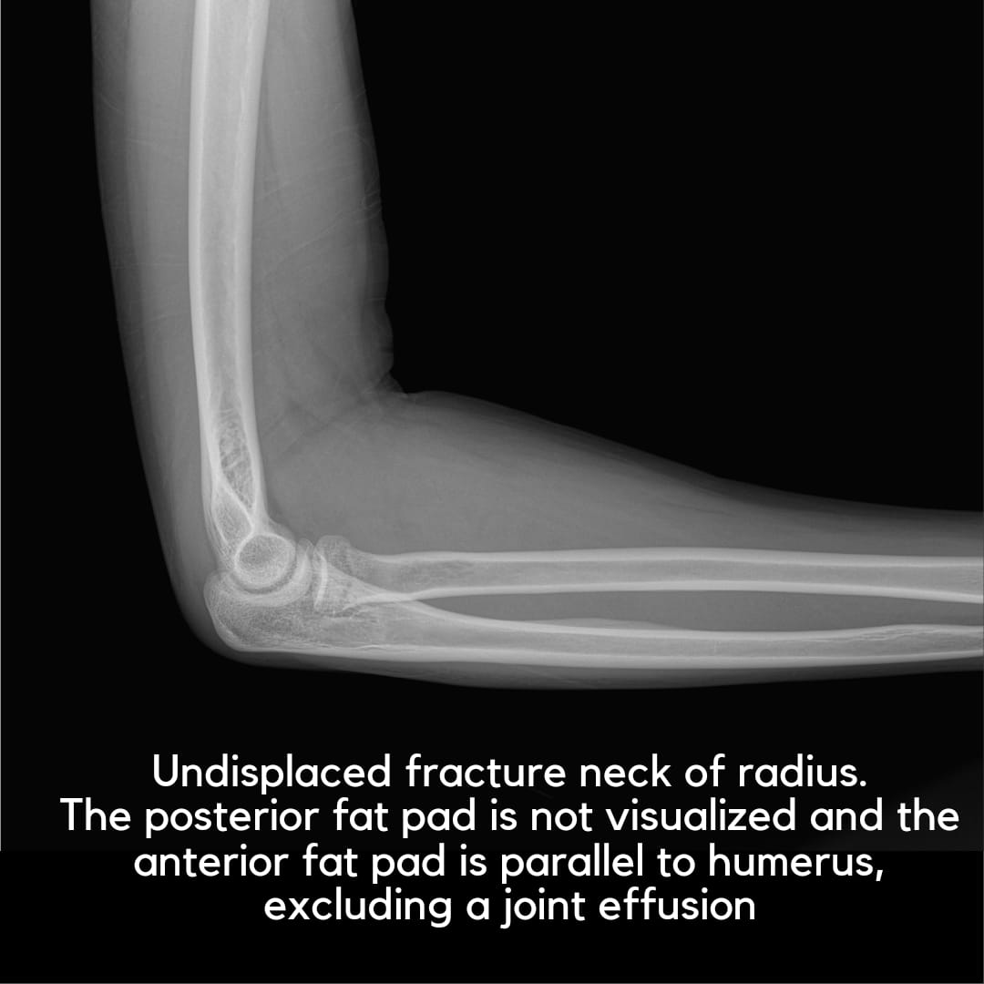 Orthopaedic Tutorials tweet media