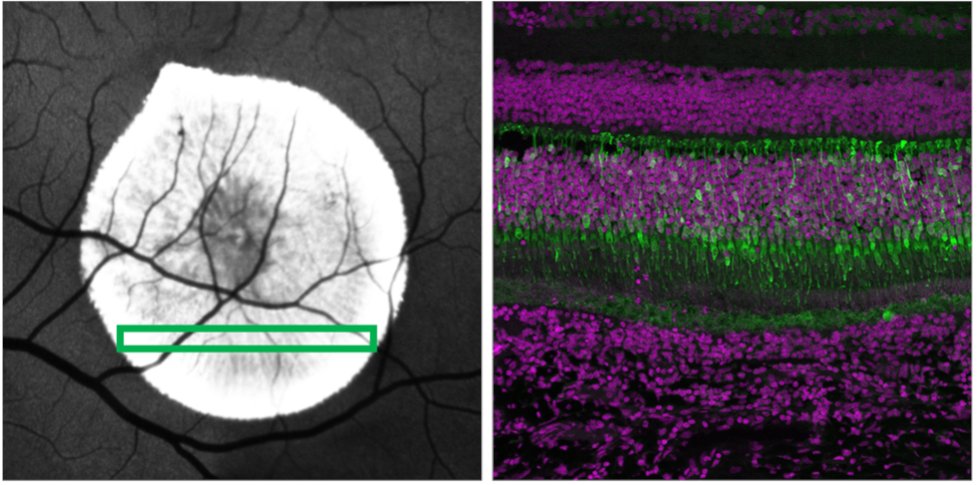 From @OregonState: a new type of lipid nanoparticle that could help deliver gene therapy to the eye (mice and non-human primate models). @PNASNews paper: bit.ly/49ZLiQQ #NEIfunded @CaseyEye @OSUPharmacy @sahayg1