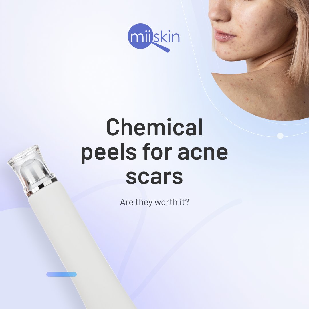 Online dermatologists and prescriptions | Miiskin tweet media