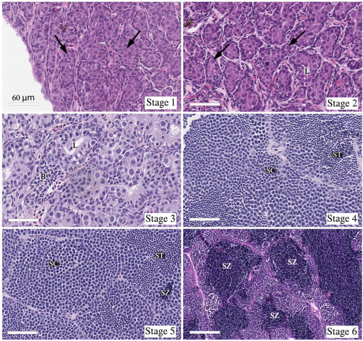 Fishes_MDPI's tweet image. #FishesMDPI #Highly_Accessed_Paper

&quot;Constant High #Temperature Promotes Early Changes in Testis Development Associated with #SexualMaturation in Male Atlantic #Salmon (Salmo salar L.) Post-Smolts&quot; by Enrique Pino Martinez et al.

👉 mdpi.com/2410-3888/7/6/…

#growth #earlypuberty