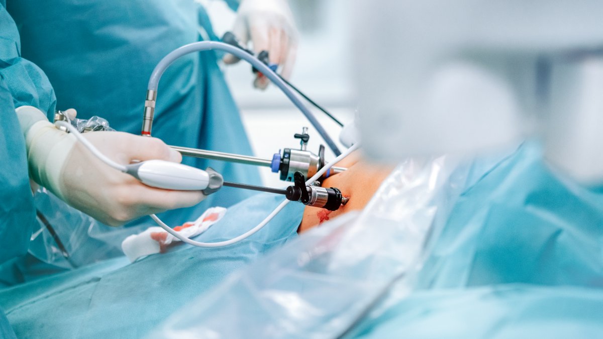 Maximise your learning opportunities and skills in laparoscopic surgery with 12 simple tips from this popular #Bulletin article.

From choosing the right tasks to actively seeking feedback, read the full list of tips for trainees: ow.ly/xeCs50QQVMe