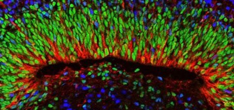 Crean #organoides a partir de células recogidas en el #embarazo 

omniprex.com/crean-organoid…