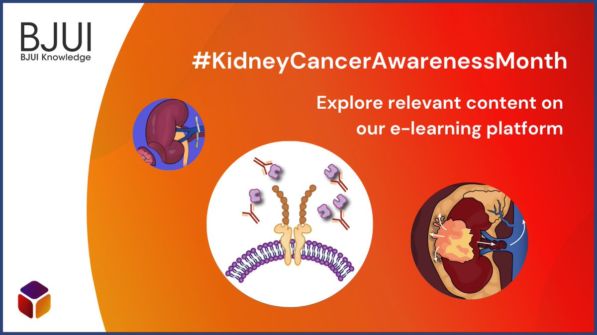 🗓️ This #KidneyCancerAwarenessMonth, watch the procedural video to learn how to perform right-sided laparoscopic #nephrectomy – from the accredited e-learning module. bjui.pub/Kidney-Nephrec… @KidneyCancer #kidneycancer #urology