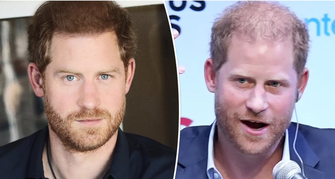 The CONSTANT “fakery” of “photos” by the “Devious Duo” can easily be challenged by just looking at the “Spare’s LACK of HAIR!” #ShushHarry #MeghanMarkleExposed #LayOffKate