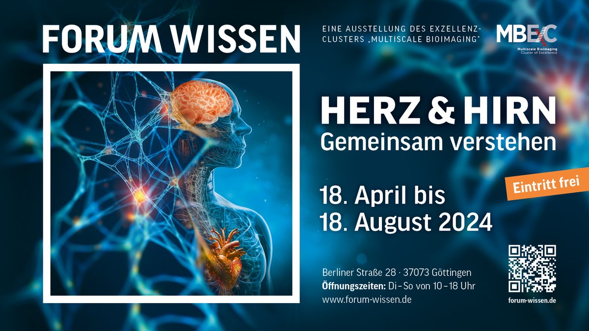 Mit innovativen bildgebenden Verfahren können Forschende <a href="/uniGoettingen/">Uni Göttingen</a> und <a href="/yourUMG/">Universitätsmedizin Göttingen (UMG)</a> die Strukturen von Herz &amp; Hirn und die Entstehung von Erkrankungen beider Organe immer besser erforschen. Einblicke gibt unsere Ausstellung „Herz &amp; Hirn — gemeinsam verstehen“. Ab 18. April!