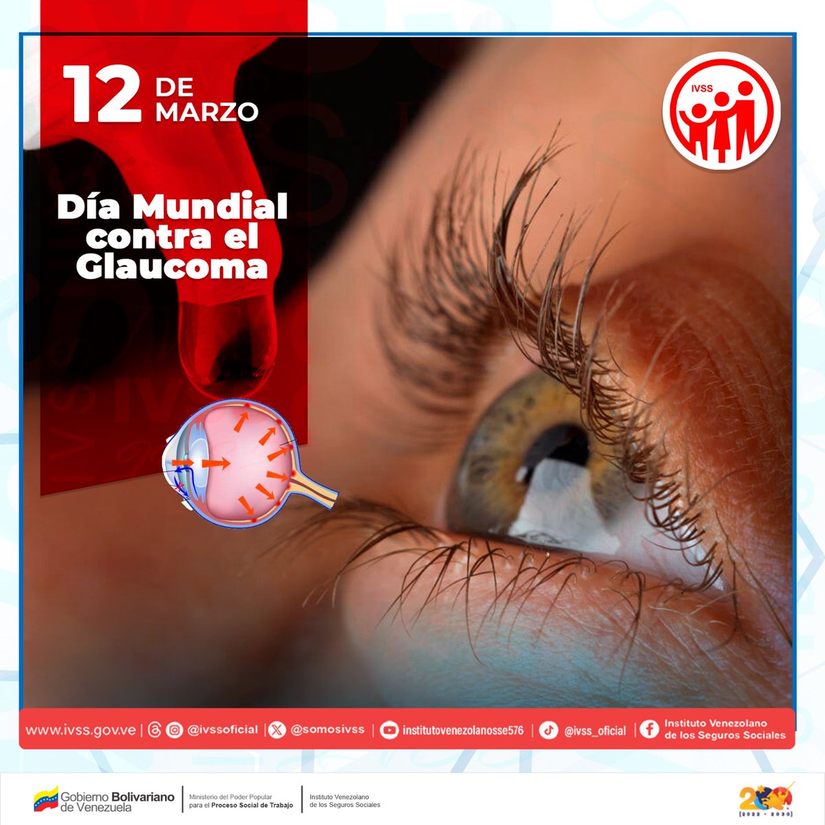 Somosivss's tweet photo. #Hoy se celebra el Día Mundial contra el Glaucoma, una enfermedad ocular que afecta a millones de personas en todo el mundo.
 
En el Instituto Venezolano de los Seguros Sociales nos unimos a esta importante causa en nuestros centros de salud del país.

#SomosCompromisoPatrio https://t.co/dPf4lKmtbm