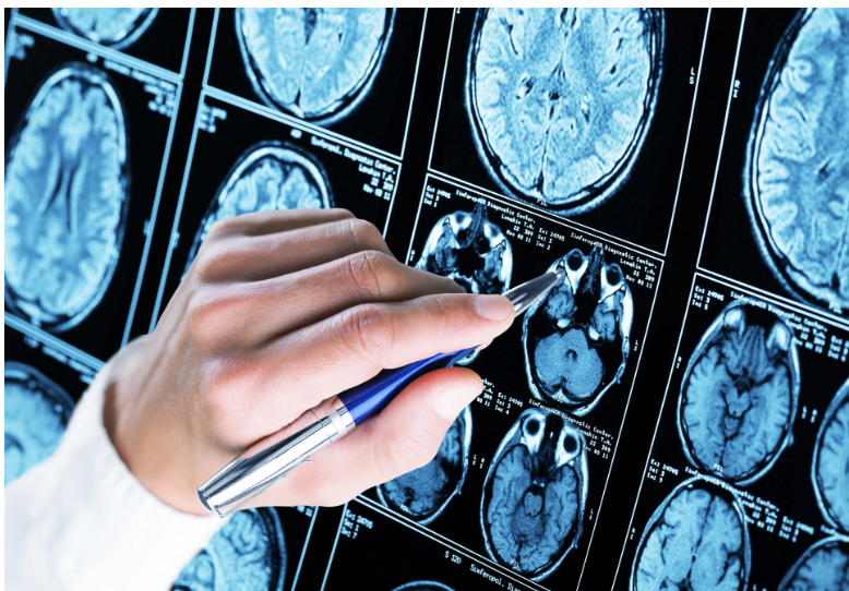 The FDA may delay the approval of donanemab for the treatment of Alzheimer disease. Click the link to learn more and follow Pharmacy Times for continued updates.  bit.ly/3Trxolb