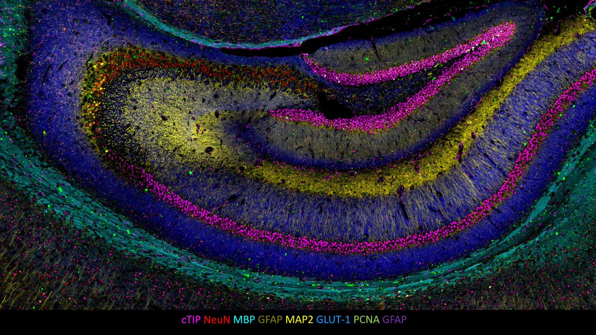 For today's #TissueTuesday, we're featuring high-plex #PhenoCyclerFusion images of the mouse brain. 

The first image presents a whole slide view of a mouse brain, showcasing the normal brain tissue and the presence of #Glioblastoma. The second image zooms in on the hippocampus