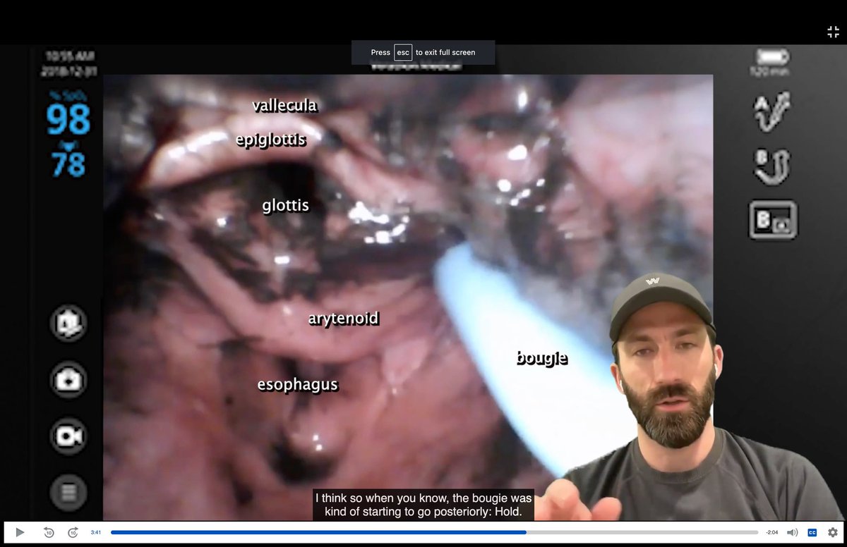 Apirotte's tweet photo. March 2024 AOTM! Burn vs coffee-ground emesis. Email me if you need access (totally free, open!): apirotte@kumc.edu.  @AirwayMxAcademy @dastrainees @ProtectedAirway @AirwayOnDemand @JohnCSakles @jducanto @TBayEDguy https://t.co/b0Lu4UDfdl