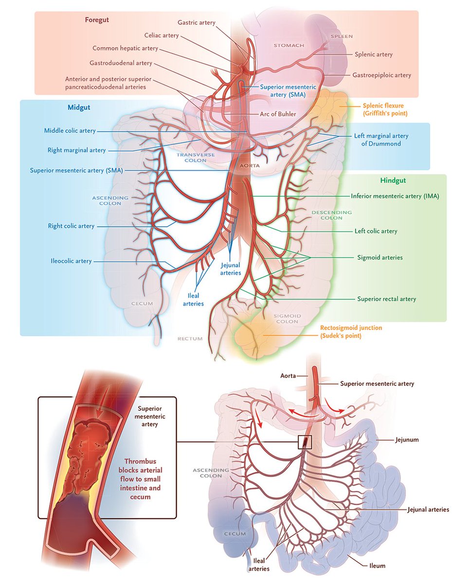 Theodore et al. provide an overview of intestinal anatomy and the pathophysiology and etiology of intestinal ischemia. Read the full review: eviden.cc/48uEJok

#Surgery #CriticalCare