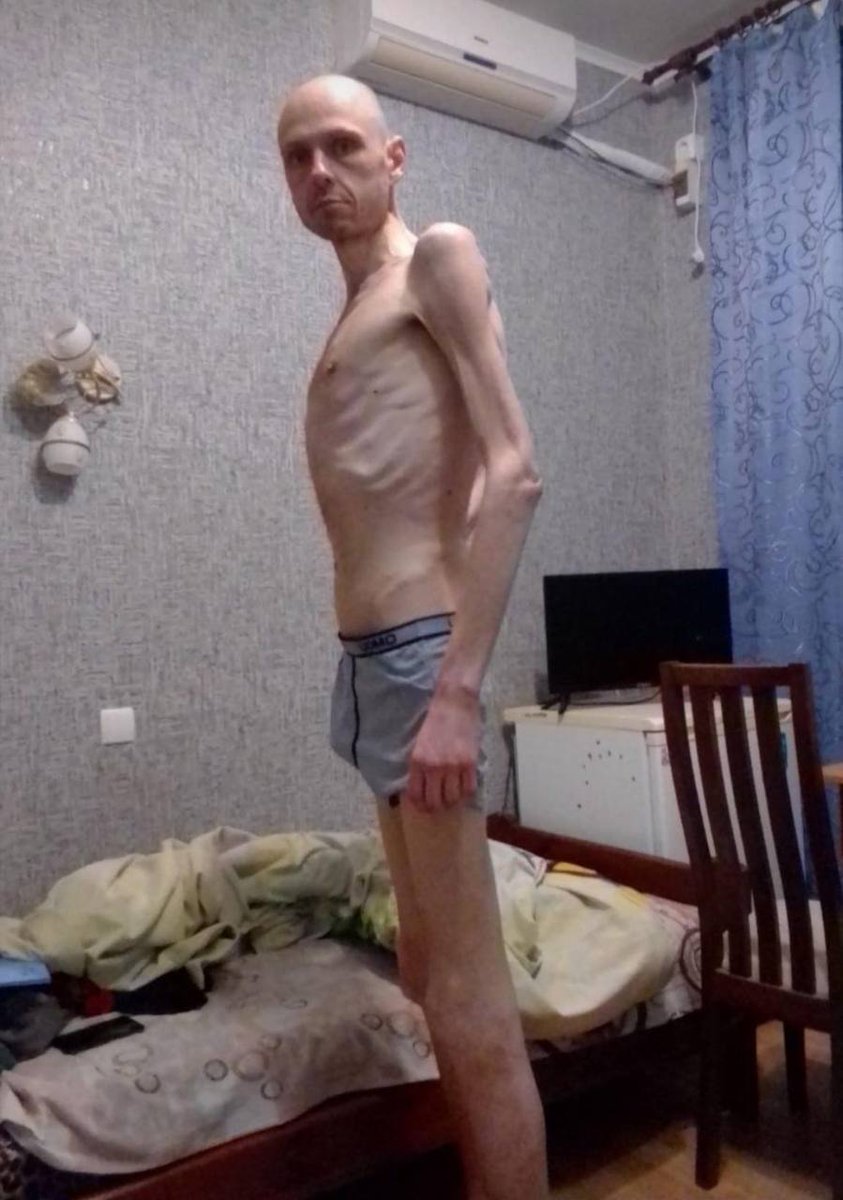 27 Ukrainian musicians from military bands are currently in Russian captivity. Their whereabouts remain unknown. 
Volodymyr Tsema-Bursov (on the photo), a tuba player, was released this January in a prisoner exchange. He says that the musicians are being regularly beaten,