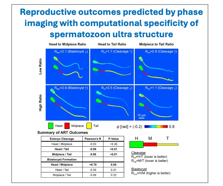 phioptics's tweet photo. Researchers at the UIUC Beckman Institute used Phi Optics SLIM and AI to predict reproductive outcomes based on sperm cells dry mass measurements.
#SpermAnalysis #ReproductionResearch #BeckmanInstitute #ART #IVF
More https://t.co/JEtf7xv2HS https://t.co/zgPMiVL9Ou
