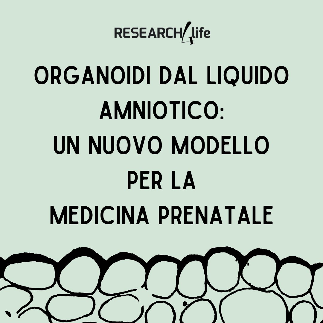 research4lifeIT's tweet photo. Uno studio descrive lo sviluppo di organoidi da cellule del liquido amniotico, evidenziandone il potenziale per monitorare lo sviluppo del feto e supportare diagnostica e #medicina prenatale. Ce ne parlano gli autori @GerliLab e @paolodecoppi
https://t.co/VNt4OxWLHT https://t.co/BhGSIDriFn
