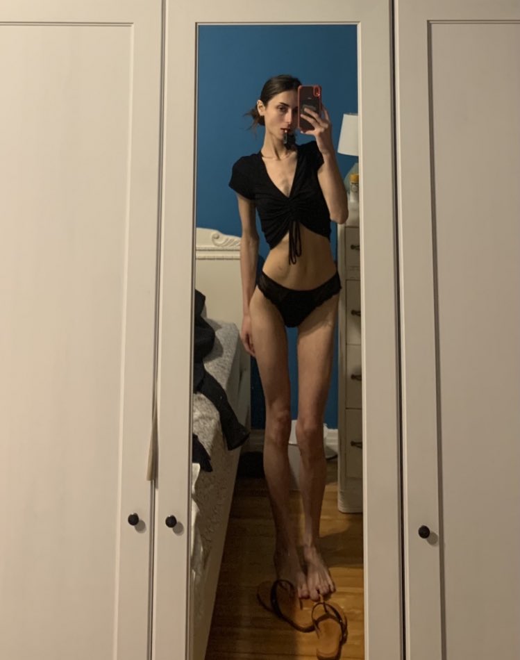 FINALLYSK1NNY's tweet photo. I did it once and ill do it again https://t.co/VqTZn4Qe1c