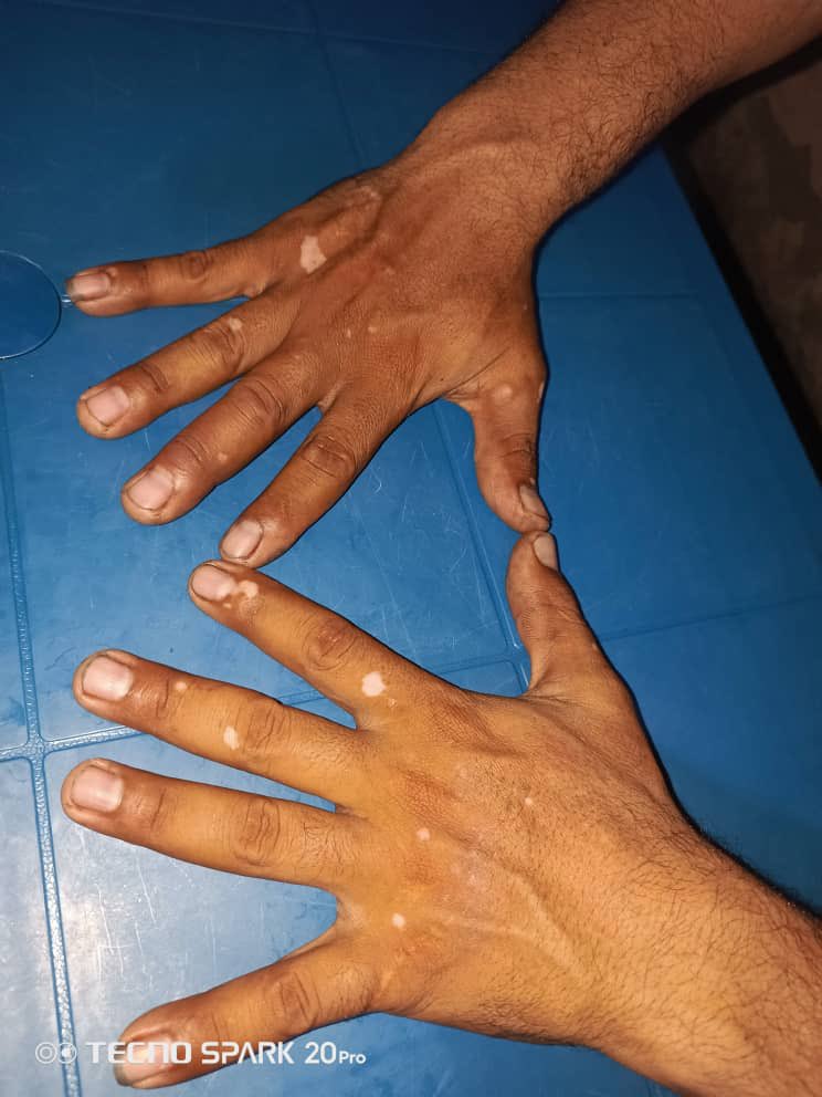 Dr Gracian Rondón tweet media