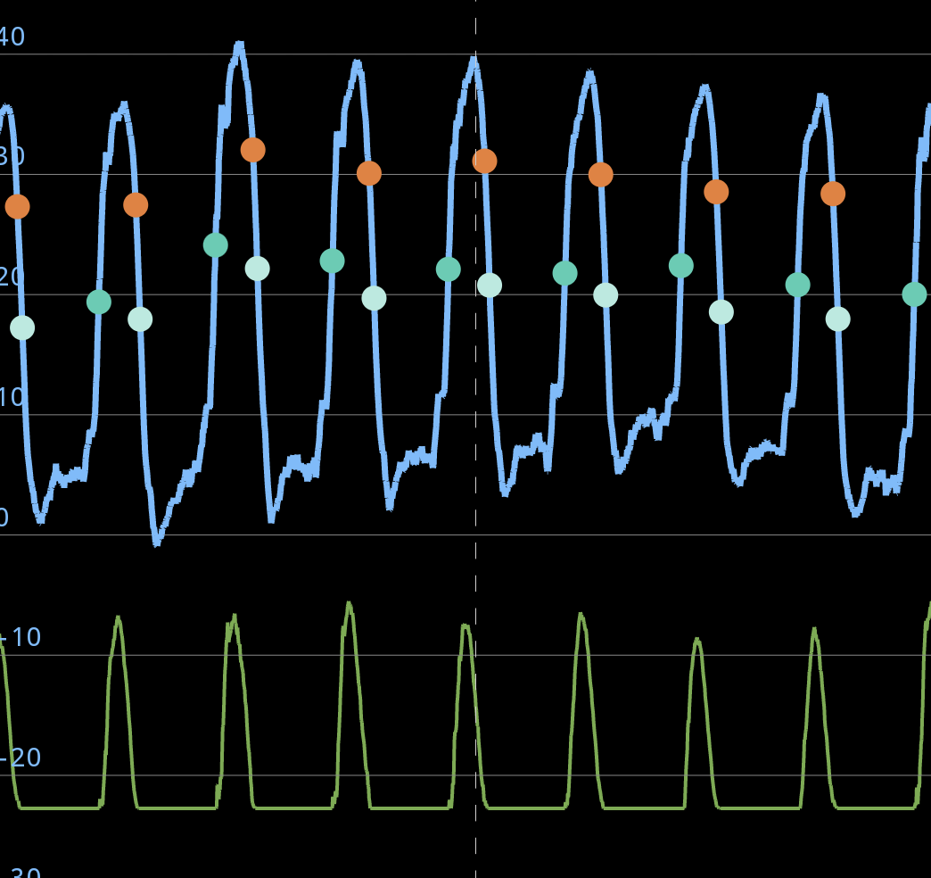 emkamedical's tweet photo. Is it possible to extract flow waveforms 🌊 from pressure?  Yes! We are currently working hard to implement this novel method in to CorLog App for continuous, beat-to-beat, wireless stroke volume and cardiac output. #hemodynamics #CorLog Learn more:
https://t.co/4nOuNXbIah https://t.co/61V6H7GkeX