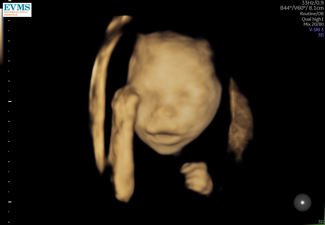 This morning Beans got to see the baby move around for the first time. We also got part of a 3d scan. Baby looks really happy and was moving around alot. 👶