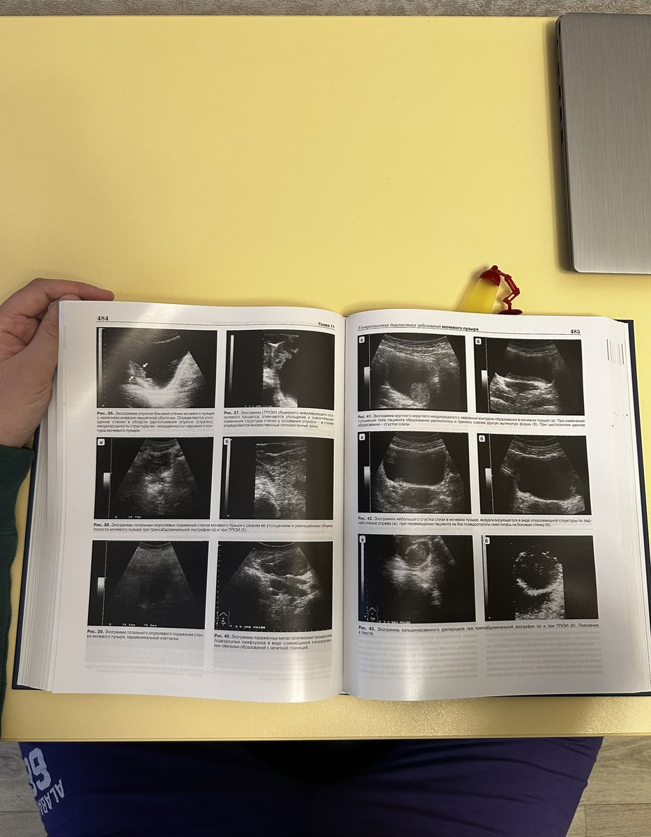 Решил немного расширить свой профессиональный горизонт)
Ближайшие месяцы посвящу изучению 256 оттенков серого)