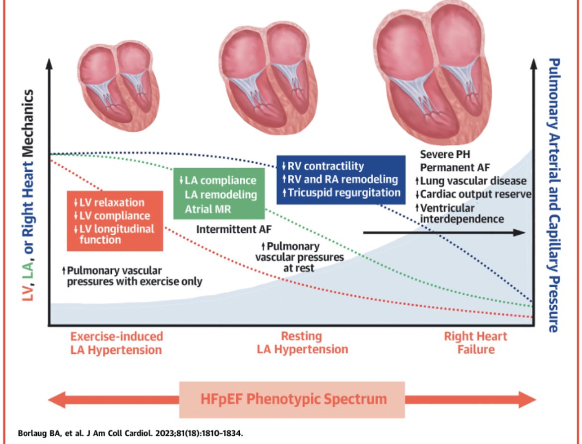 ZHeart11768530's tweet photo. 🔴 Heart Failure With Preserved Ejection Fraction: 2023 @JACC Scientific Statement
📥https://t.co/ItrNmgqlGb
#cardiology #CardioTwitter #CardioEd #medical #medicine #meded #medtwitter https://t.co/JtHshGM3G3