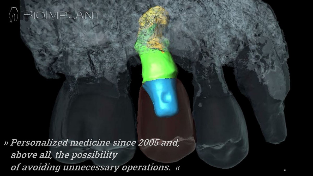 BioImplant (@bioimplant) on Twitter photo 