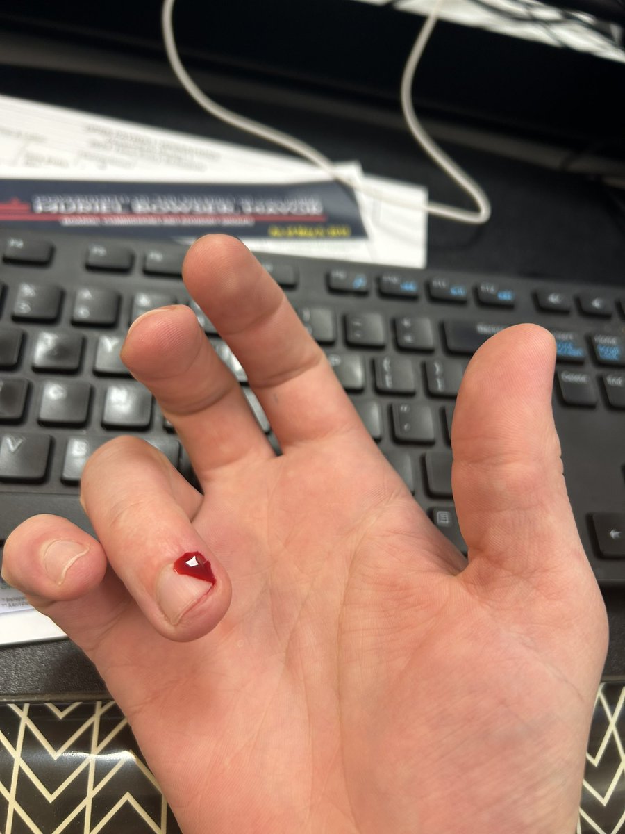 Having an extremely Normal reaction to mild workplace conflict (which I’m not even involved in)